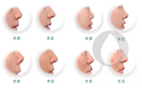 微整形训练