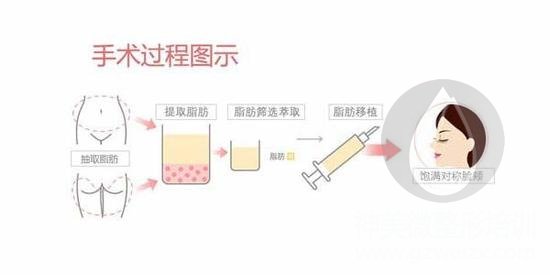 手术过程