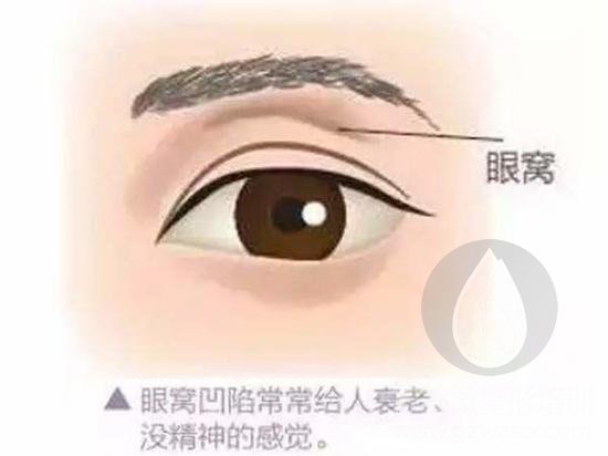 眼窝深陷
