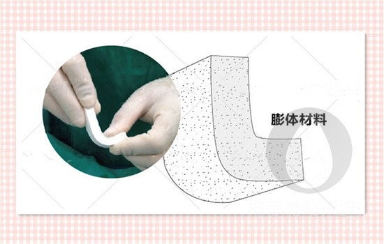 膨体材料