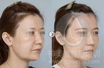 效果对比