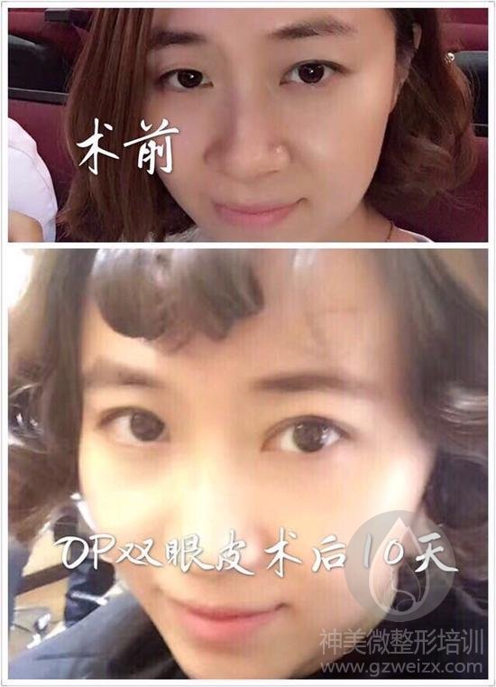 案例对比
