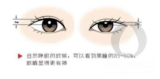 瞳孔(黑眼珠)曝露率