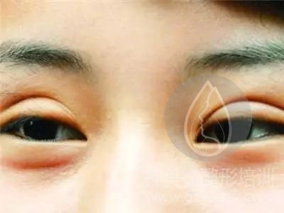 痕迹太明显