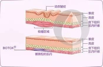 Botox作用原理