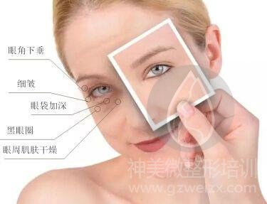 眼周年轻化