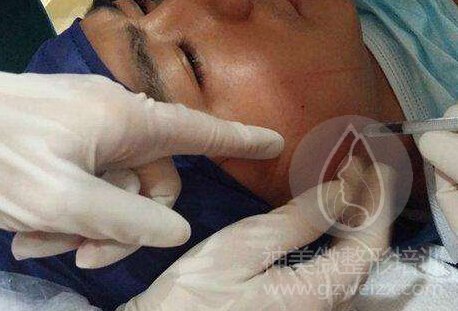 广州微整形咨询师培训