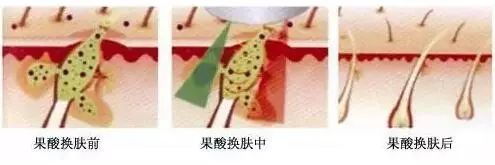 皮肤
