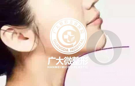 线雕如何祛川字纹-微整形培训