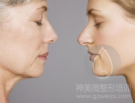 广州线雕你适合做吗?线雕微整培训