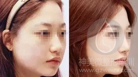 对比
