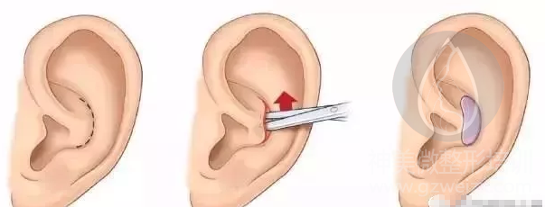 QQ截图20180304102903.png