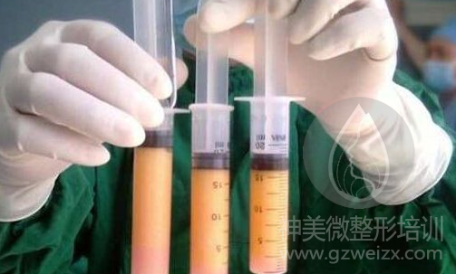 微整形自体脂肪注射